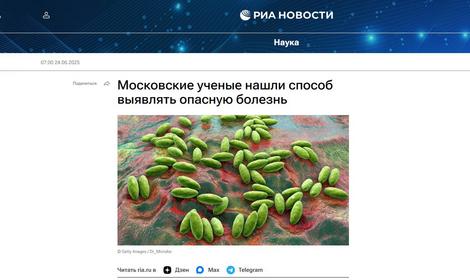 РИА Новости: новый биохимический маркер поможет точнее диагностировать бруцеллез